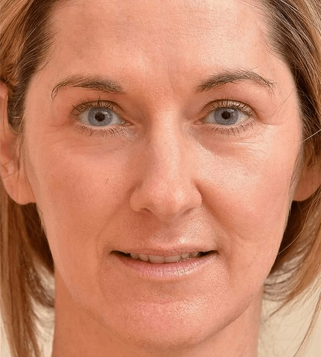 Po uporabi kreme Eudalie izgledam mlajše